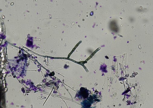 soil microorganisms under a microscope including amoeba, flagellates, nematodes, fungi, bacteria	