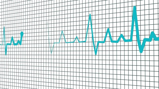 Heartbeat line on graph paper showing an irregular ecg pattern with a flatline section animation