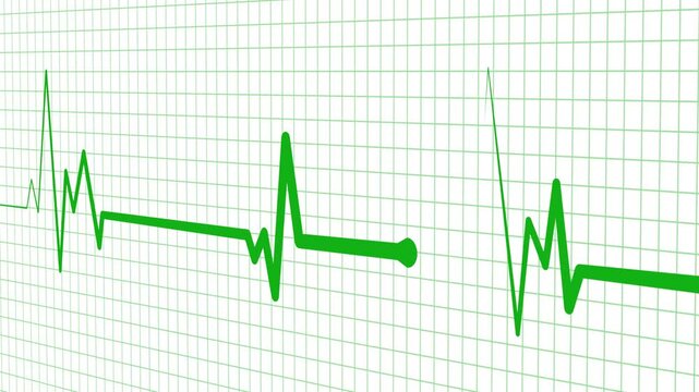 Health heartbeat line medical ekg rhythm pattern health monitor signal and heart activity chart animation