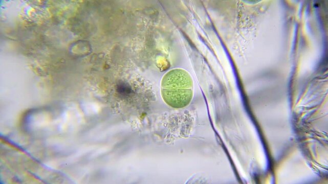 Dividing cyanobacteria cell with swimming ciliates and bacteria in water, microscopic view at 1000x magnification, brightfield microscopy