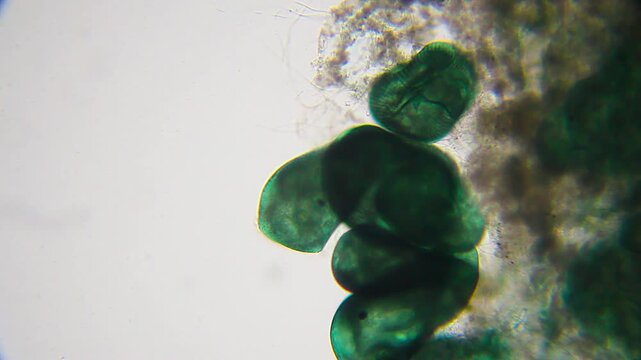 Colony of blue-green Stentor coeruleus ciliates attached to substrate, microscopic view at 100x magnification, brightfield microscopy