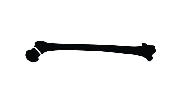 Human femur bone silhouette with a visible fracture line near the joint showing an orthopedic injury on white background.