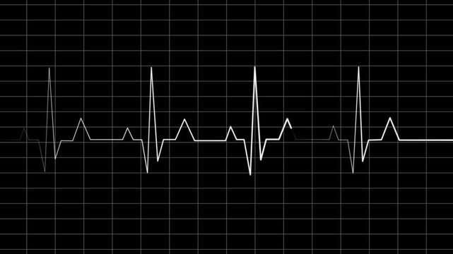 Heartbeat and pulse rate signal neon colorful technology animation on grid background.