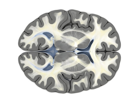 Cross section of human brain showing white and gray matter on white background.