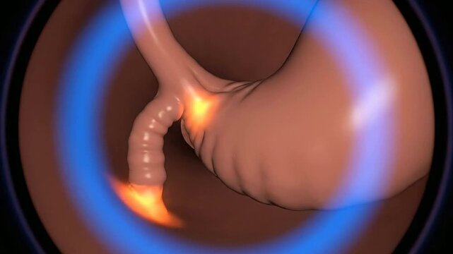 4K Endoscopic Diagnostic Journey Through Gastrointestinal Tract Unveiling Stomach Interior with Detailed Medical Visualization