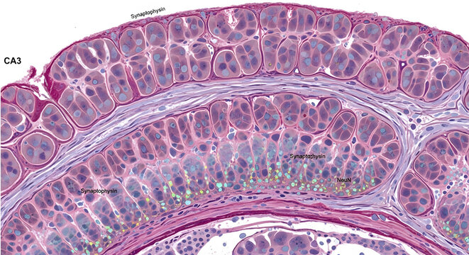Detailed Light Micrograph of Hippocampus CA3 Region Showing Neuronal Cell Layers and Histological Staining