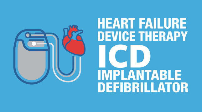Heart Failure Device Therapy ICD Implantable Defibrillator Vector
