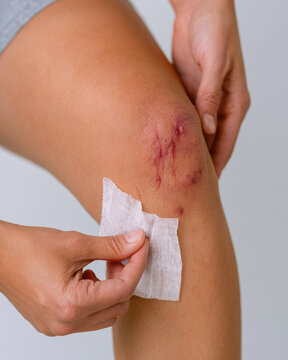 Cleaning knee scrape wound with gauze pad, gentle first aid care on leg, close up view against clean light background