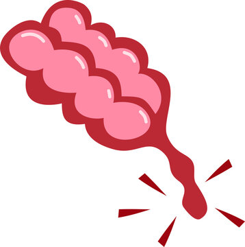 inflamation of the appendix illustration organ