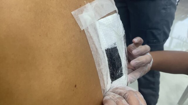healer is applying a poultice to a lump on the back of a male patient.