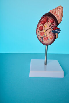 Detailed anatomical kidney model on stand. Diagnostics of renal hypertension and nephropathy.