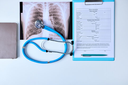 Stethoscope lies on a doctor's desk next to medical documents and a chest x-ray of a patient in a pulmonology department. Treatment of lung diseases