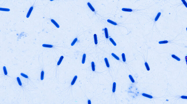 Blue bacteria under microscope