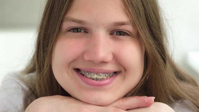 Face of smiling teenage girl with metal dental braces, close up portrait. Orthodontic treatment concept