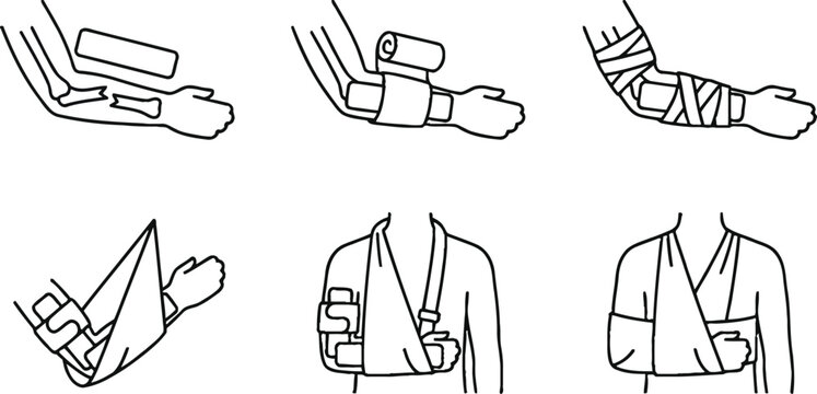 Step-by-step first aid illustration set demonstrating proper bandaging techniques and arm sling application for various injuries isolated on white