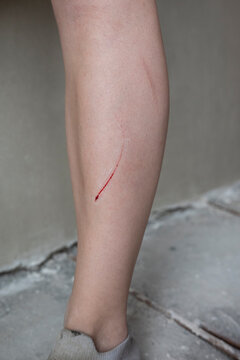 Woman's leg with a bleeding cut after a workplace accident at a construction site. Concept of occupational injury