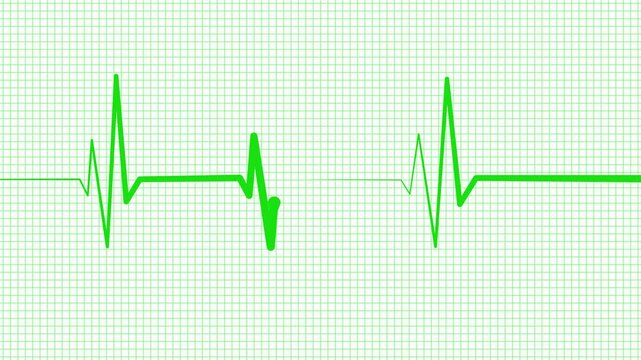 Medical Pulse Tracker Animation with Digital ECG Signal, Heart Rate Analysis Animation Featuring Medical Wave Signal