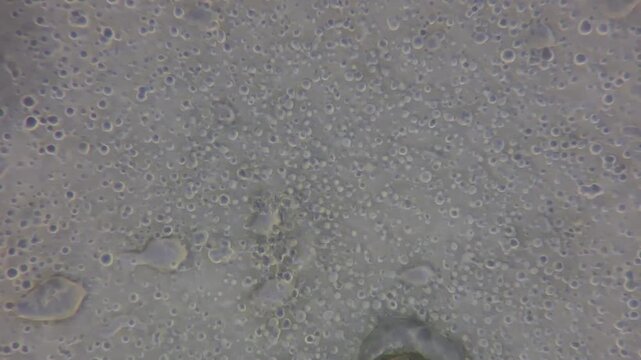 Whipped Cream Under Microscope Showing Fat Globules and Air Bubbles