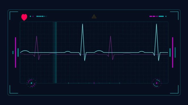 Dynamic Heart Rate Monitor ECG Visualization Sequence.