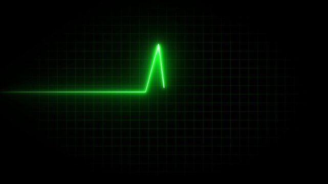 Bright green glowing heartbeat line on a dark grid background representing a medical electrocardiogram monitor display for health and science