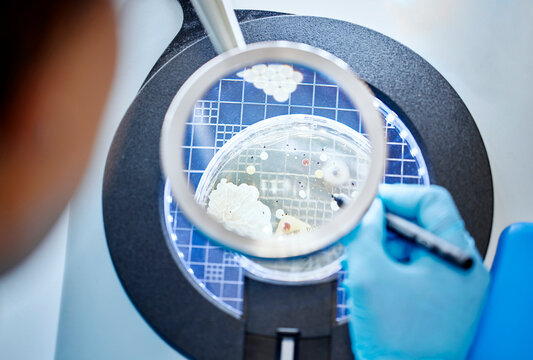 Close-up of scientist analyzing a sample in a microbiological lab