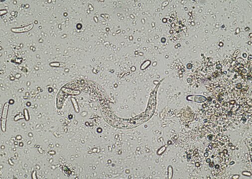 soil microorganisms under a microscope including amoeba, flagellates, nematodes, fungi, bacteria	
