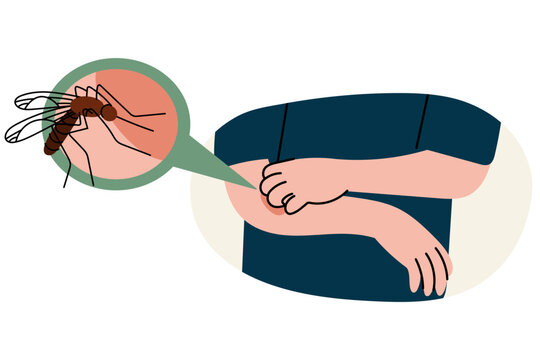 Person scratching itchy mosquito bite on arm after insect sting. Skin irritation, allergy, summer insects, itching, outdoor health and bug bite concept. Flat vector illustration