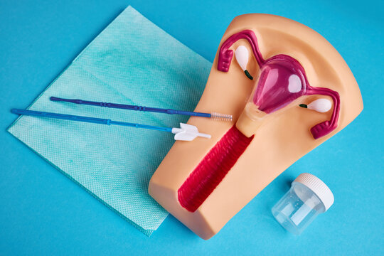 Cervical cancer screening model with Pap smear collection tools. Concept of gynecological prevention and early diagnosis