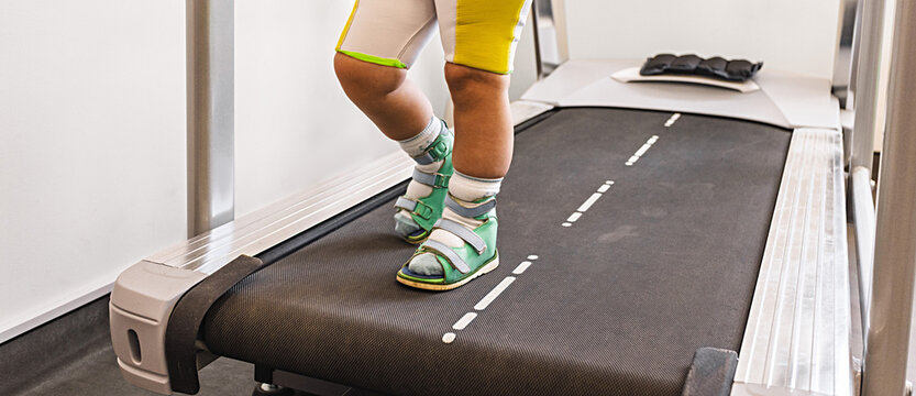 Physical rehabilitation. Child in orthopedic shoes practices walking on a treadmill during rehabilitation movement disorders