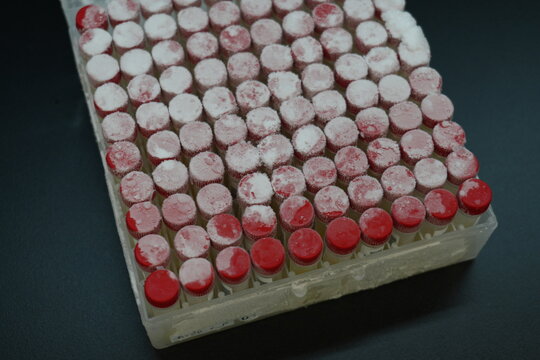 Frozen laboratory cryovials stored in a biobank freezer rack.