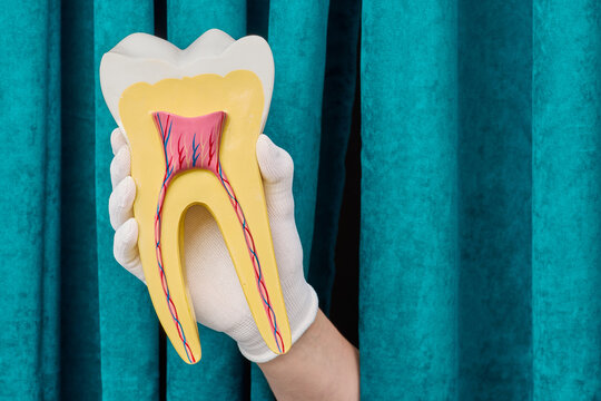 Gloved hand holding detailed cross section anatomical model of human molar tooth. Modern dentistry diagnostics and deep caries treatment strategy.