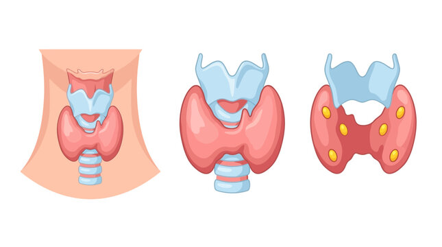Thyroid Anatomy Diagram Set featuring neck cross-section and gland close-ups on white background ideal for medical education and endocrine system presentations.