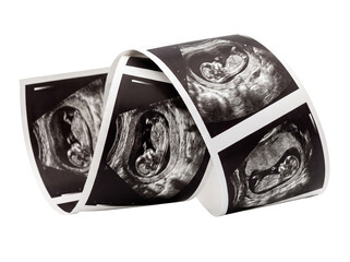 Baby ultrasound scan strip photo showing fetus development in pregnancy, displaying curling medical sonogram prints for prenatal care, obstetrics checkup, and family planning concepts. © Fernando