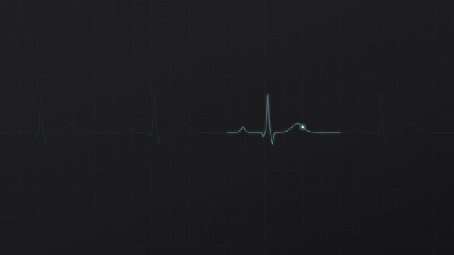 ECG Heartbeat Monitor Line Pulse Green Seamless Loop 4K