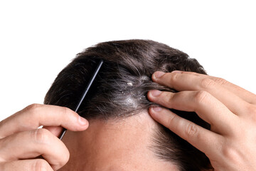 Fototapeta premium Dandruff problem. Man with comb examining his head on white background, closeup