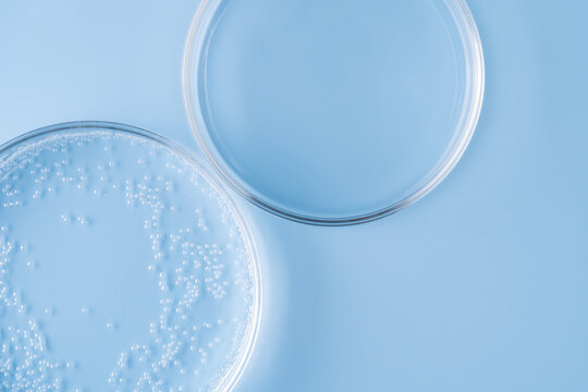 Petri dish with l colony on blue lab background