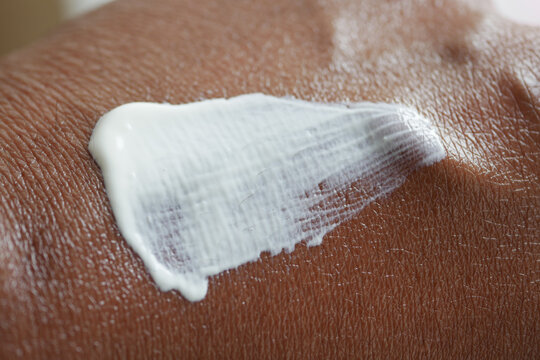 Applying lotion to skin for moisture