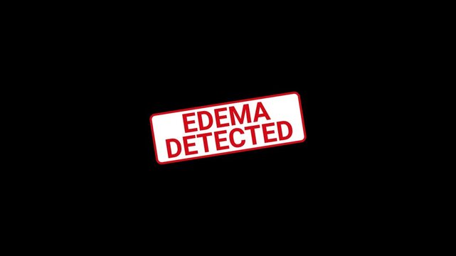 Edema Detected Stamp Animated