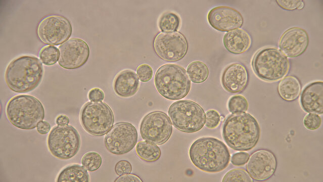 Microscopic yeast cell colony budding structure under laboratory magnification, showing spherical transparent organism cluster in close up biological science view
