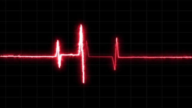 Heartbeat Monitor Animated Video, Heartbeat Medical Cardiogram Animation