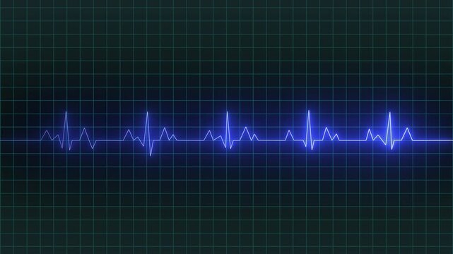 Bright heart rhythm background, heartbeat monitor blue line monitor shows heartbeat, EKG machine at veterinary clinic during surgery, heartbeat on screen, Motion graphics of heartbeat concept 4k video