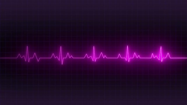 Bright heart rhythm background, heartbeat monitor pink line monitor shows heartbeat, EKG machine at veterinary clinic during surgery, heartbeat on screen, Motion graphics of heartbeat concept 4k video