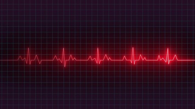Bright heart rhythm background, heartbeat monitor red line monitor shows heartbeat, EKG machine at veterinary clinic during surgery, heartbeat on screen, Motion graphics of heartbeat concept 4k video