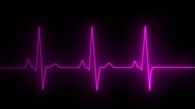Pink color EKG heart line monitor. Emergency EKG monitoring. pulse line. ECG heartbeat monitor. Motion graphics of Electrocardiogram Medical 4k video.