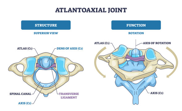 Atlantoaxial joint diagram highlights atlas C1, axis C2, and dens, showing cervical rotation mechanics and the stabilizing transverse ligament, transparent background