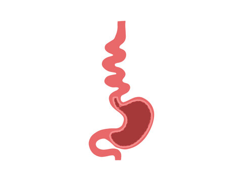 Diffuse Esophageal Spasm