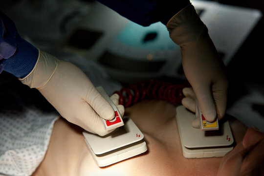 Hands of doctor holding defibrillator on patient's chest in hospital