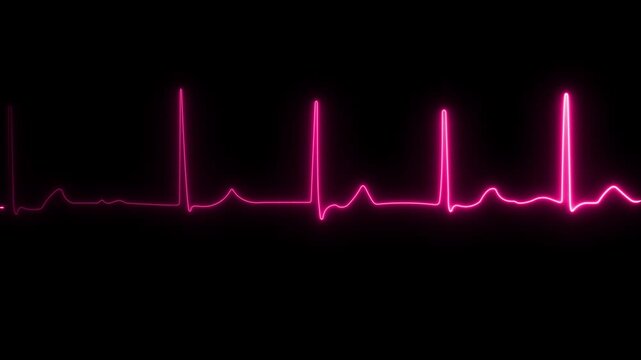 Neon pink ekg heartbeat monitor pulse line animation on black background, medical