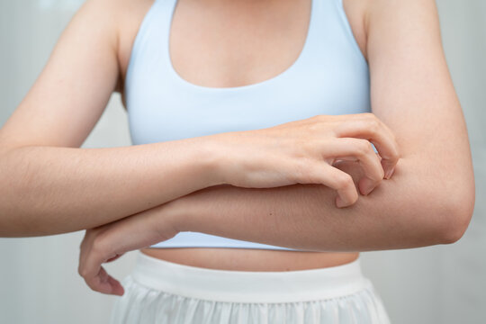 Asian woman itching of skin diseases using hand scratching.
