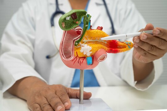 Pancreatitis, pancreatic cancer, Asian doctor with pancreas, gallbladder and bile duct human model.